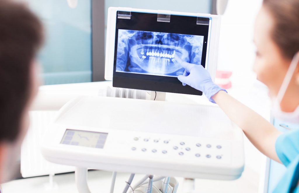 Dental X-Rays In Singapore